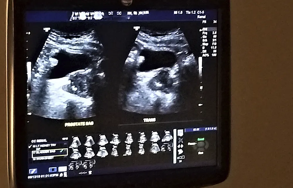 Nefrologia Brasília